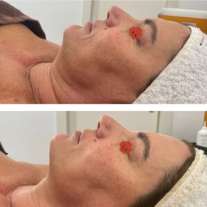 Centro estetico con visita nutrizionale a Torino